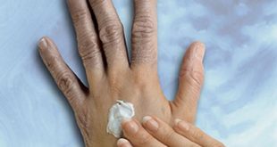 La crème éclaircissante pourrait endommager les nerfs, selon un rapport du CDC skinlighteni 310x165